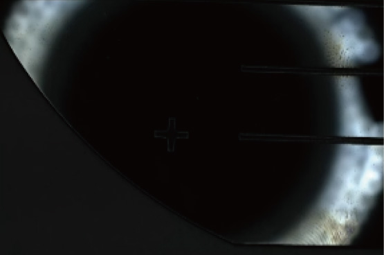 DiverLight